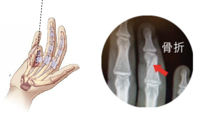 Hand injuries overview 2